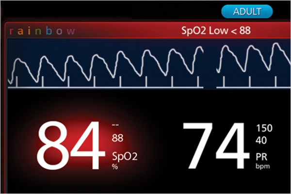 Rad-97 screen displaying an SpO₂ alert with oxygen saturation at 84% and pulse rate at 74 bpm, illustrating low oxygen alarm functionality.