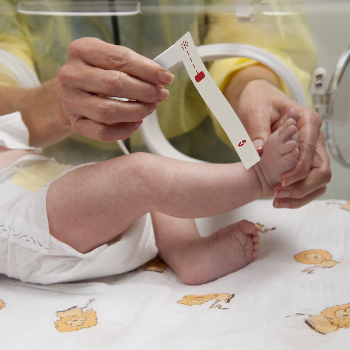 Bebé en la incubadora de la unidad de cuidados intensivos neonatales de un hospital con un médico aplicando un sensor de oximetría de pulso Masimo. 