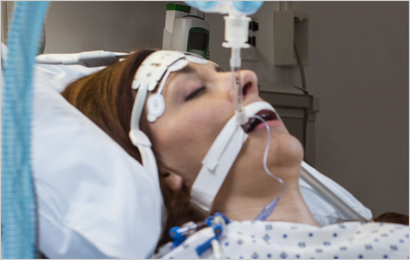 Paciente dormida e intubada en una cama de hospital siendo monitorizada con un sensor Masimo.